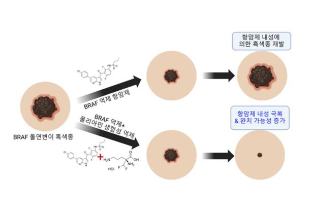KIST, 새 흑색종 항암제 개발 전략 제시…	“내성 발성 억제”