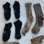 ‘이걸 왜 먹어..?’ 식탐 강한 개 뱃속에서 발견된 충격적인 물건