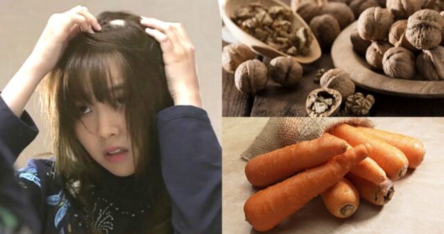 머리숱 점점 적어져 고민이라면… ‘이것’ 먹어야 ‘대머리’ 안된다