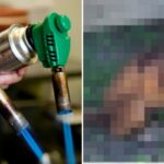 토치로 ‘전신화상’ 입은 유기견, 구조 하루만에 숨져… “유사한 학대로 이미 사망한 강아지 발견”