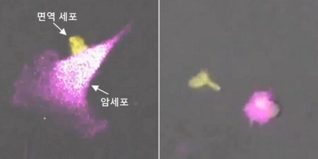 자기보다 몸집 훨씬 큰 암세포 때려잡는 ‘면역세포’의 전투력 수준(영상)