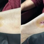버스에서 팔 살짝 닿았다고… 3세 아이 ‘쌍코피’ 나도록 때리고 할머니 깨문 20대 여성