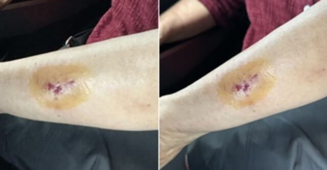버스에서 팔 살짝 닿았다고… 3세 아이 ‘쌍코피’ 나도록 때리고 할머니 깨문 20대 여성