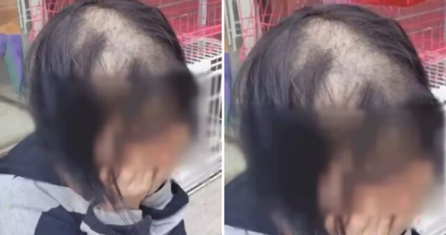“집 앞 미용실서 염색했다가 머리카락 다 끊겨 ‘대머리’ 됐습니다” (사진)