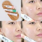 고민별로 골라쓰는 여드름연고 3가지