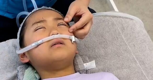 “코·가슴도 시킬 것”… 9살 딸에 ‘쌍수’ 시켜주고 수술 과정 공개한 일본인 엄마 (영상)