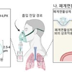 KAIST, 흡입 치료 최적화된 mRNA 전달체 개발…“26배 효과적인 폐질환 치료”