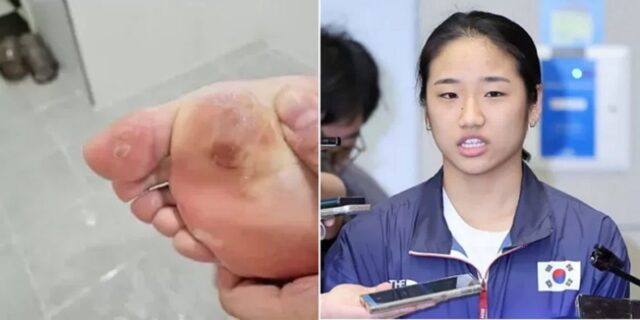 “한시적, 제한적, 예외적”… 안세영, 드디어 신고 싶었던 신발 신는다