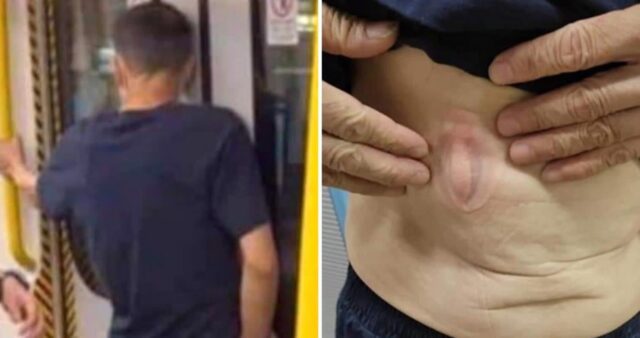 지하철서 후다닥 뛰어내리려다 문에 ‘뱃살’ 낀 아저씨… “치료비 받아야” vs “본인 잘못”