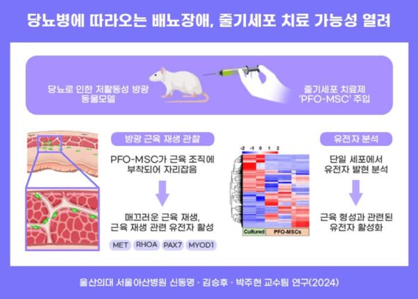 당뇨로 인한 배뇨장애, 줄기세포로 치료