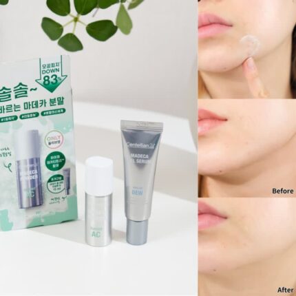 얼굴트러블 필수템 센텔리안24 마데카 분말 티트리 AC 올영에서 겟해요