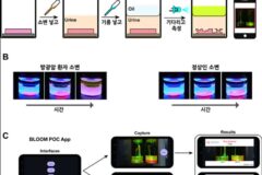 KIST, 소변용 방광암 진단키트 개발…민감도 88.8% 달해