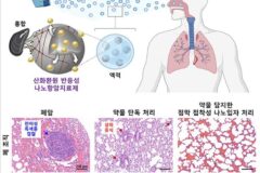 폐 점막에 직접 작용하는 ‘흡입형 폐암 치료제’ 개발