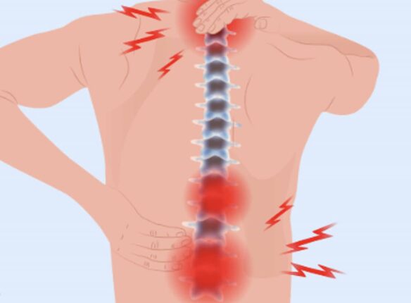 허리염증 원인 단순 통증 뿐만 아니라 급성 근육 염좌 혹은 염증성 자가면역 기전 질환 관련있다면