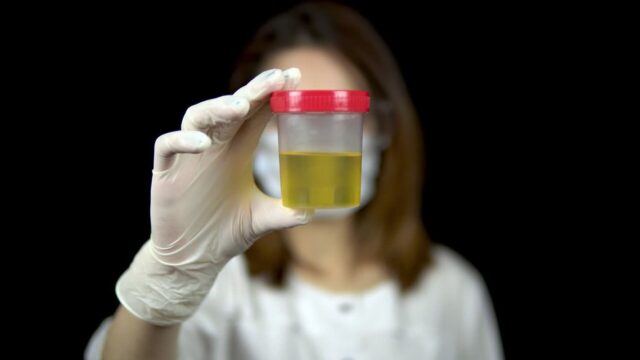 단백뇨 의심 증상, 소변 탁하고 거품이 부글부글한다면?