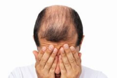 [알쓸건강] 봄철에 더 심해지는 탈모? 계절성 탈모에 주의하세요!