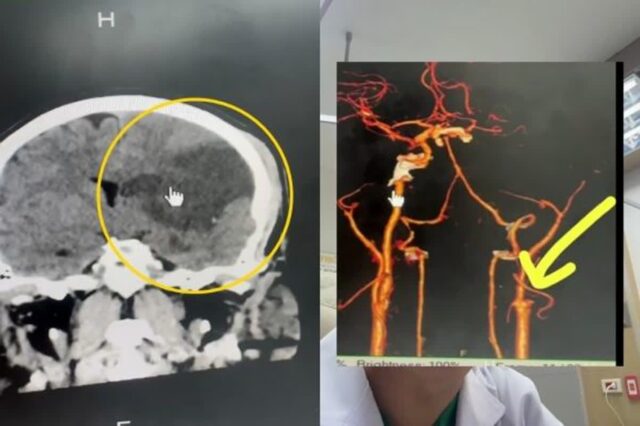 “목 뻐근해 아내가 마사지 해줬을 뿐인데…” 불구 된 남편
