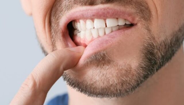 잇몸 간지러움 원인 단순 가려움 넘어 따끔거리는 느낌까지 든다면