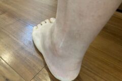 맥주 아닙니다 “통풍 유발” 이 음료들이 무려 4배 더 위험합니다.