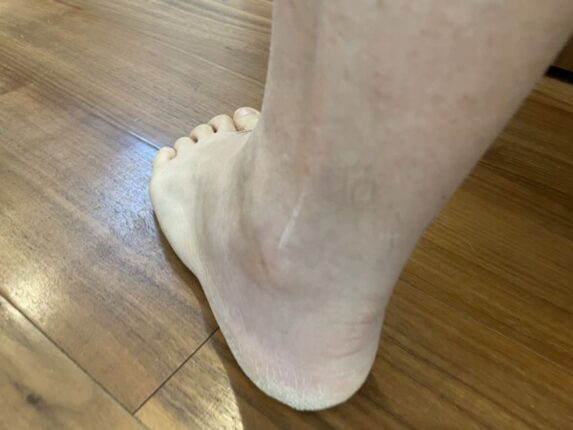 맥주 아닙니다 “통풍 유발” 이 음료들이 무려 4배 더 위험합니다.