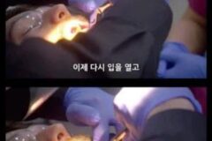 자 마취 안하고 사랑니 뽑을게요 레드썬