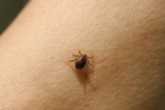 “가을철에 가장 위험” 진드기 퇴치, 제거 방법 총 정리