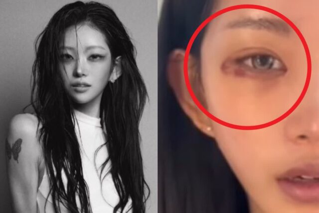 ‘최진실 딸’ 최준희, 퉁퉁 부은 눈 공개…팬들 걱정