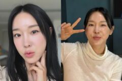 ‘시술 부작용’ 이지혜, 최근자 모습… (+사진)