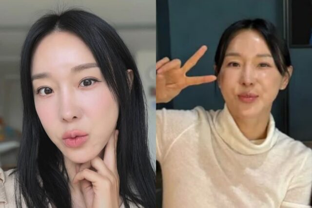 ‘시술 부작용’ 이지혜, 최근자 모습… (+사진)