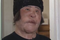 ‘선풍기 아줌마’ 한혜경, 성형 부작용… 결국 ‘별세’