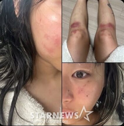 “감금에 부엌 칼..그냥 살고 싶었습니다” AOMG 女래퍼, ‘데이트 폭력’ 피해 호소