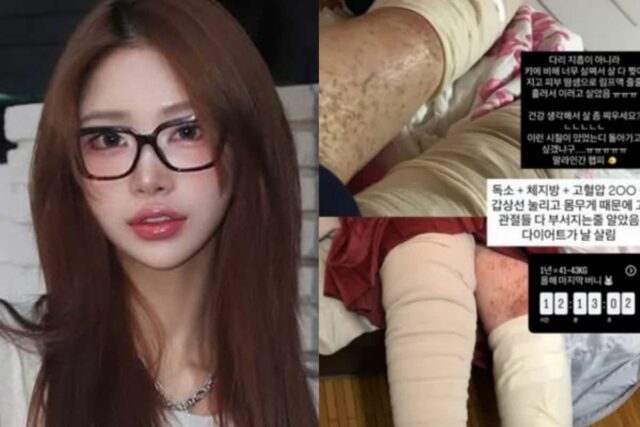‘故 최진실 딸’ 최준희, 위태로운 상태…