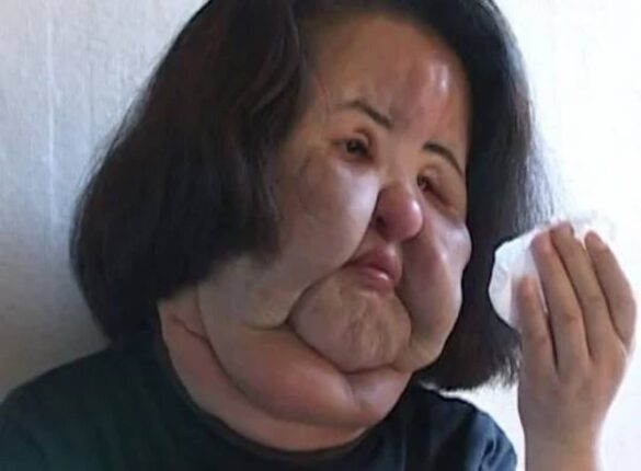 선풍기 아줌마, 50대에 의문의 죽음… 언니가 직접 밝힌 비화는?