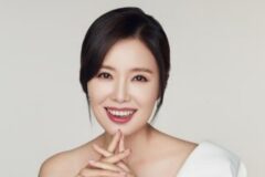 배우 하희라, 오토바이 사고 당해… 뒤늦은 입장