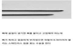 뼈 안부러져본 사람들이 의외로 모르는 사실들.jpg