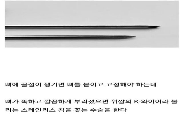뼈 안부러져본 사람들이 의외로 모르는 사실들.jpg