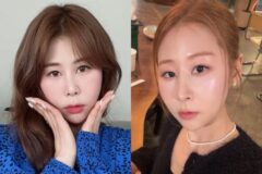 ‘코 재수술’ 박세미, 못 알아볼 뻔… (+전후 사진)