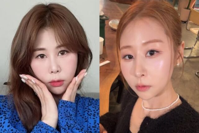 ‘코 재수술’ 박세미, 못 알아볼 뻔… (+전후 사진)