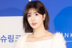 “얼굴 부상”… 권은비, 결국 ‘병원行’