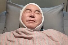’67세’ 심형래, 수술대 올랐다… 팬들 걱정