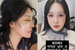 랄랄, 성형 후 확 달라진 얼굴에 당혹감…”이명화가 너무 젊어져”
