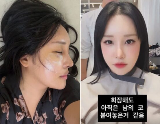 랄랄, 성형 후 확 달라진 얼굴에 당혹감…”이명화가 너무 젊어져”