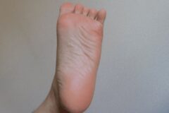 배 아닙니다..”췌장암 걸리면 가장 먼저 나온다는 초기증상” 꼭 확인하세요.
