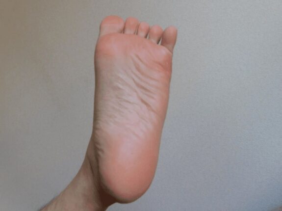 배 아닙니다..”췌장암 걸리면 가장 먼저 나온다는 초기증상” 꼭 확인하세요.