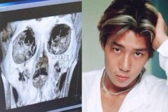 ‘룰라 이상민’ 얼굴에 박힌 철심만 수십 개? 90년대 강남 패싸움 사건의 전말은