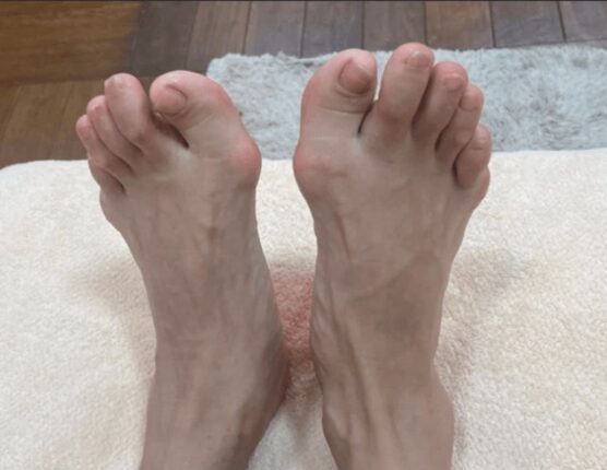 갑자기 “이런 증상”들이 보인다면, 몸이 살 빼라고 보내는 마지막 경고입니다.