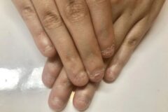 치과의사가 공개한 “치아 건강”을 빠르게 망가지게 만드는 최악의 습관.