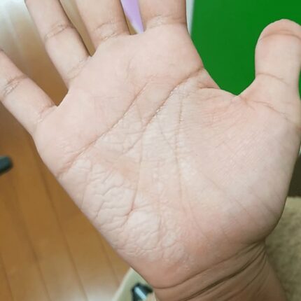 간건강이 돌이킬 수 없을 때 “이런 증상” 생깁니다, 당장 확인 하세요.