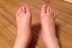 아무 이유 없이 다리에 “이 증상” 느껴지면 심장 상태가 최악인 겁니다.