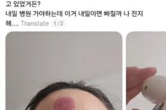 피해자들 속출하는 육아용품